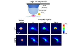 Delayed repair of nuclear envelope rupture in HGPS cells

Credit
© Kono, et al., 2024. Published by Oxford University Press on behalf of National Academy of Sciences.